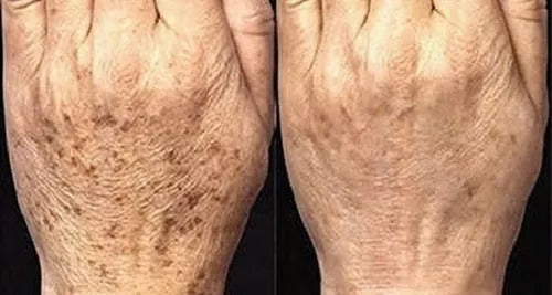 CREMA ROSAS BIOAQUA™