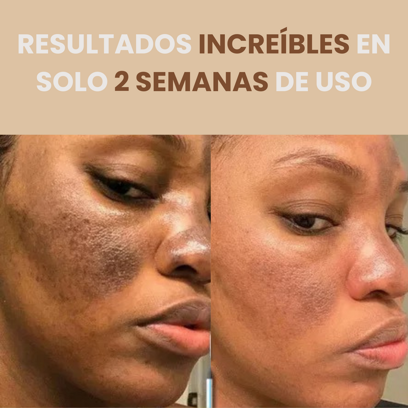 CREMA ROSAS BIOAQUA™